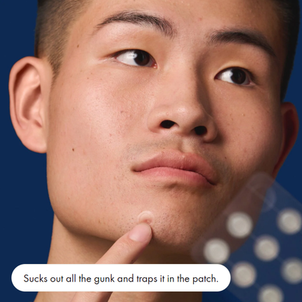 x2 Mighty Pimple patch 39 Pack - invisible+