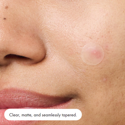 x2 Mighty Pimple patch 39 Pack - invisible+